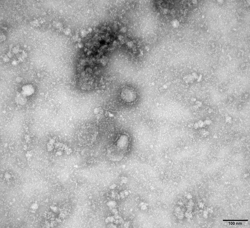 Các nhà khoa học Australia lại đạt tiến triển mới trong nghiên cứu virus corona (11/2/2020)