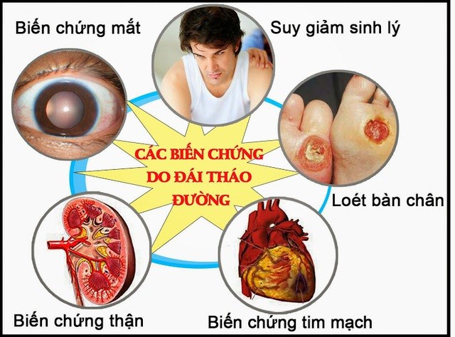 Chuyên gia cảnh báo người bệnh tuyệt đối không chủ quan với các biến chứng (05/03/2023)